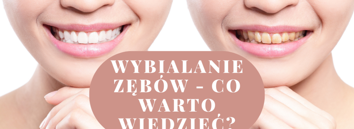 Wybialanie zębów - co warto wiedzieć?