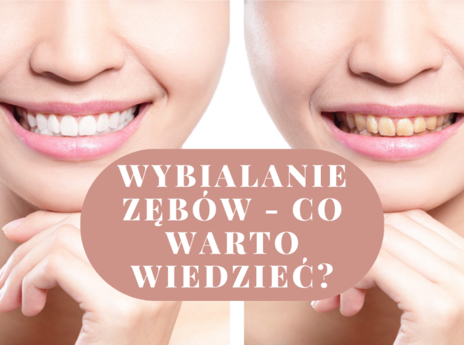 Wybialanie zębów - co warto wiedzieć?