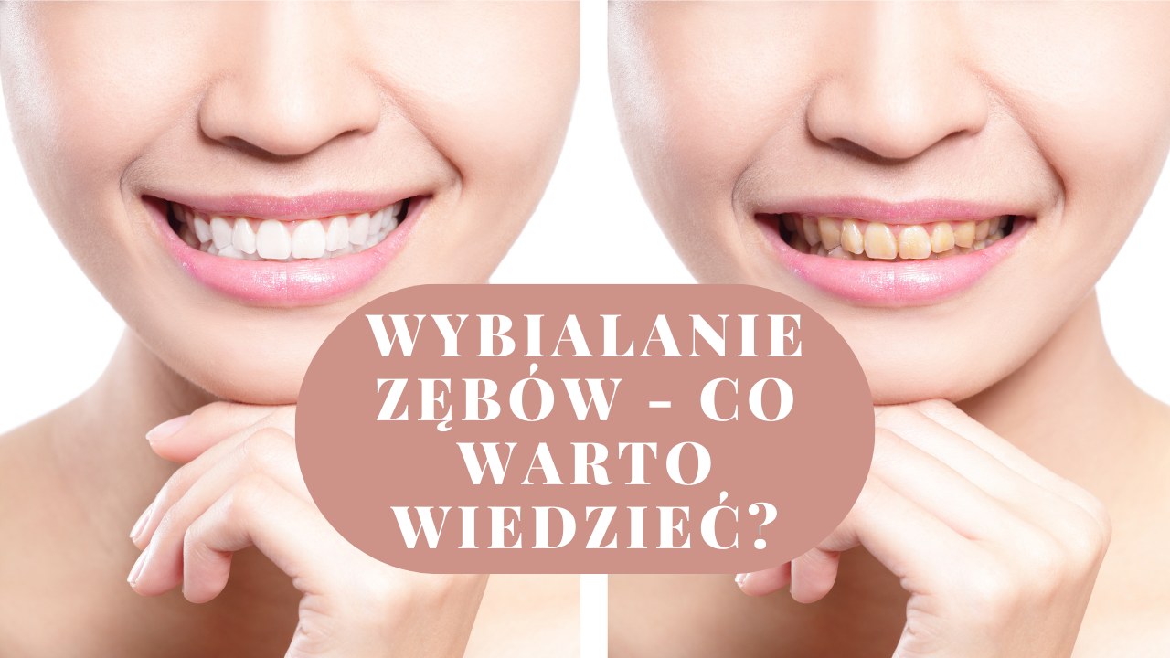 Wybialanie zębów - co warto wiedzieć?