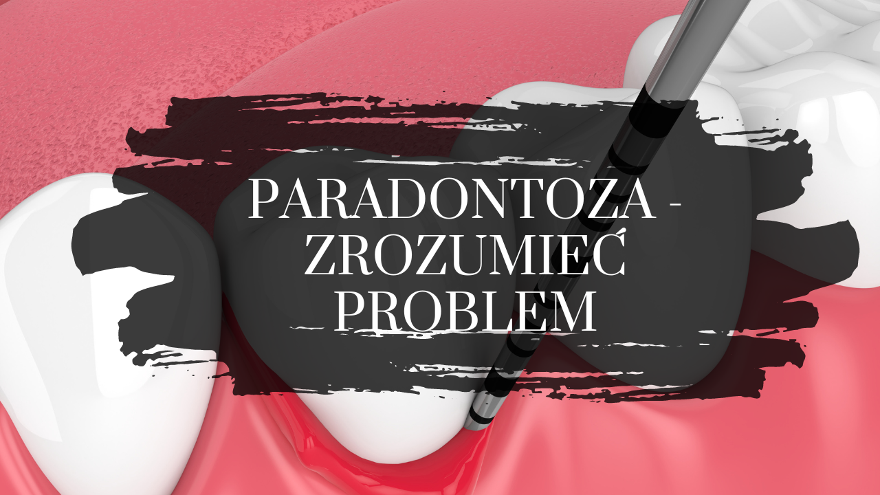 paradontoza - zrozumieć problem