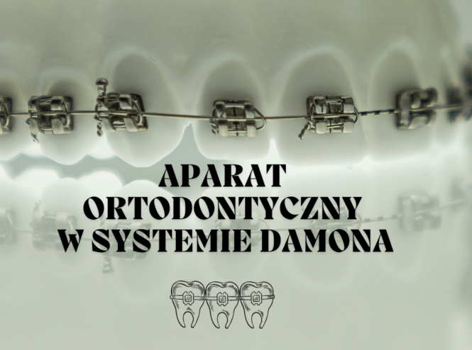 Aparat ortodontyczny w systemie Damona