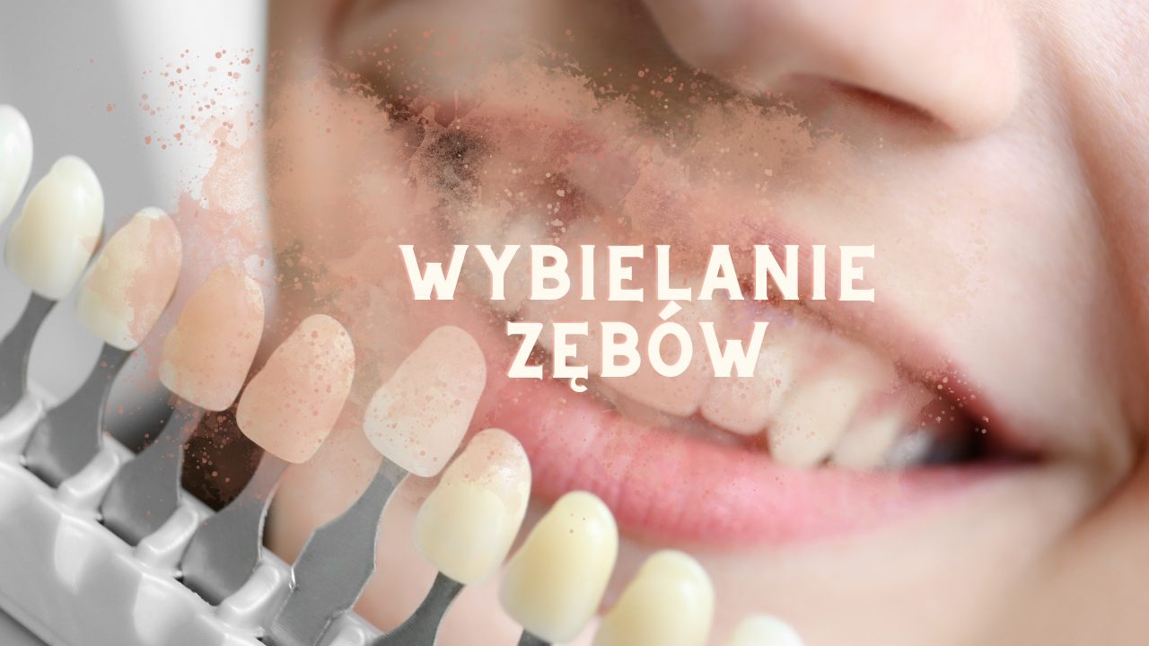 wybielanie zębów Lublin