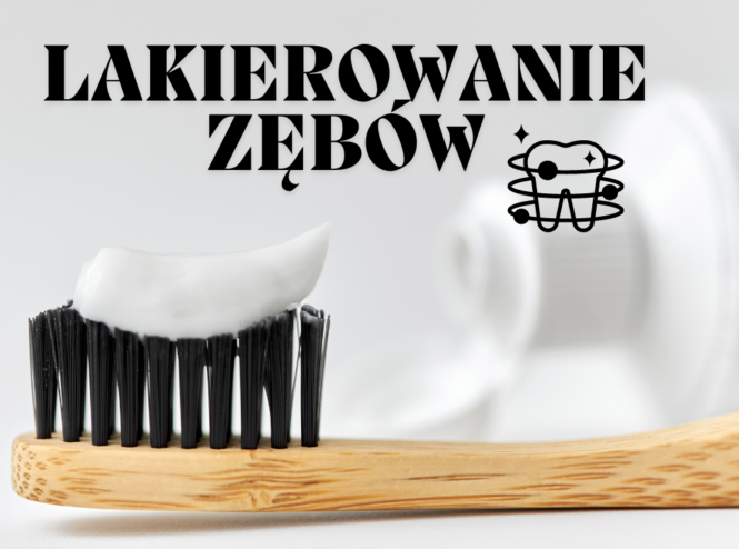 Lakierowanie zębów