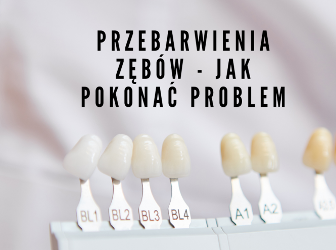 Przebarwienia zębów - jak pokonać problem