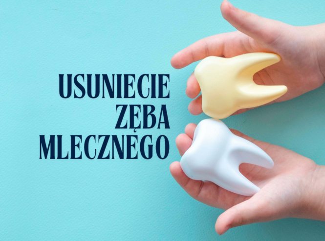 Usuniecie zęba mlecznego