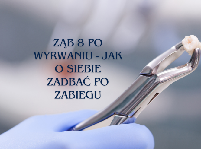 Ząb 8 po wyrwaniu - jak o siebie zadbać po zabiegu