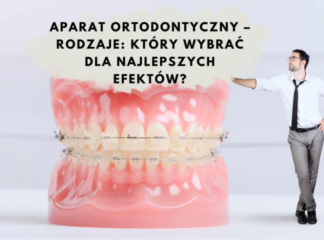 Aparat ortodontyczny – Rodzaje Który wybrać dla najlepszych efektów