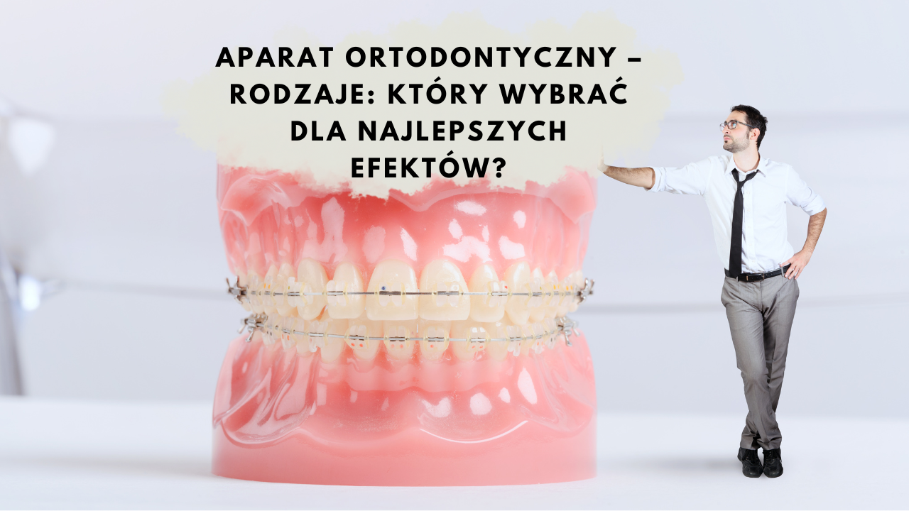 Aparat ortodontyczny – Rodzaje Który wybrać dla najlepszych efektów