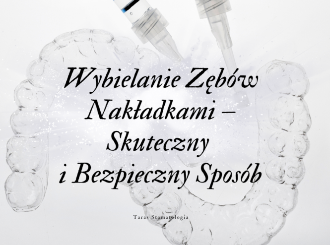 Wybielanie Zębów Nakładkami – Skuteczny i Bezpieczny Sposób