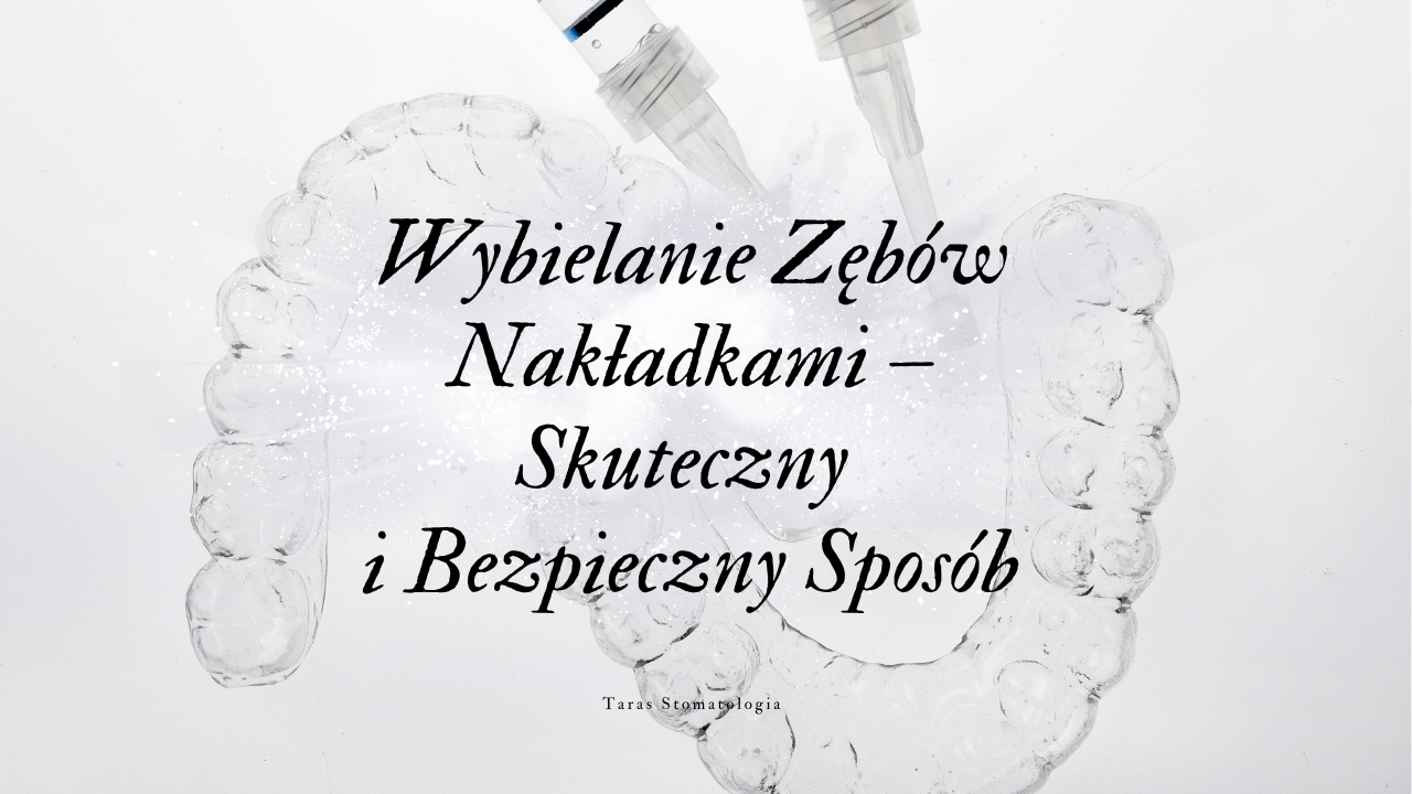 Wybielanie Zębów Nakładkami – Skuteczny i Bezpieczny Sposób