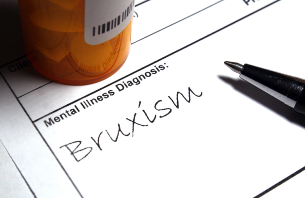 Bruksizm – co to jest i jak wpływa na zdrowie zębów