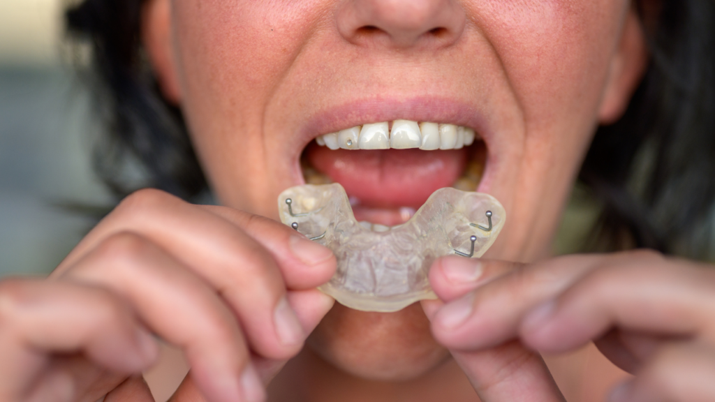 Bruksizm – leczenie poprzez kompleksowe podejście