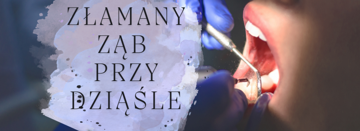 Złamany ząb przy dziąśle - co robić i jak wygląda leczenie