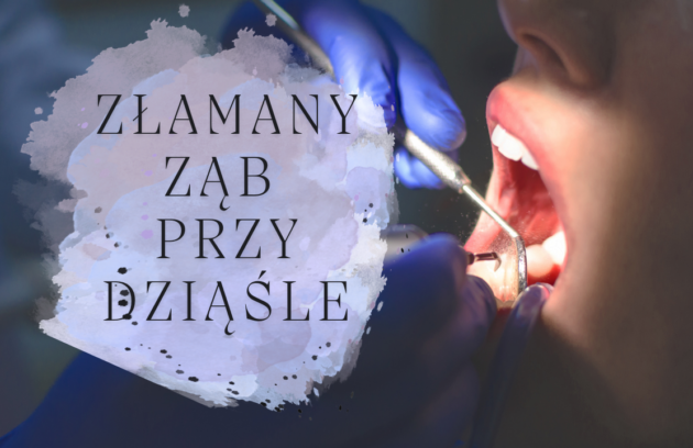 Złamany ząb przy dziąśle - co robić i jak wygląda leczenie
