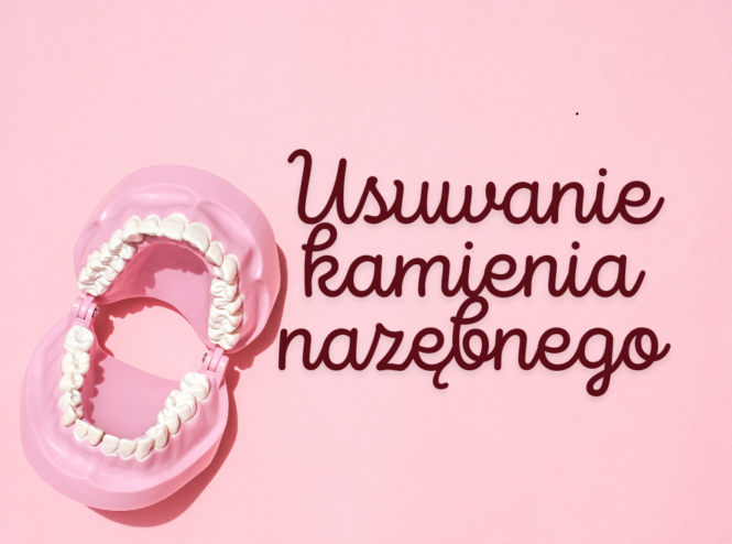 Usuwanie kamienia nazębnego - lublin stomatolog.pl