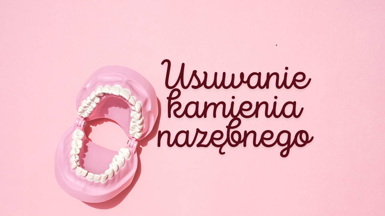 Usuwanie kamienia nazębnego - lublin stomatolog.pl