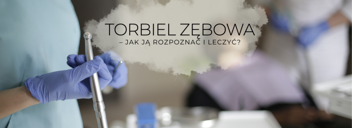 – jak ją rozpoznać i leczyć