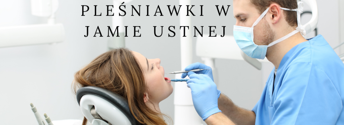 Pleśniawki w jamie ustnej - jak się z nimi uporać?