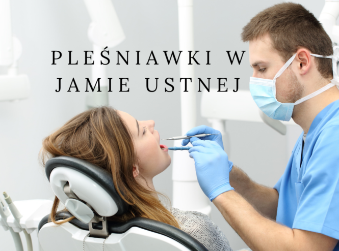 Pleśniawki w jamie ustnej - jak się z nimi uporać?