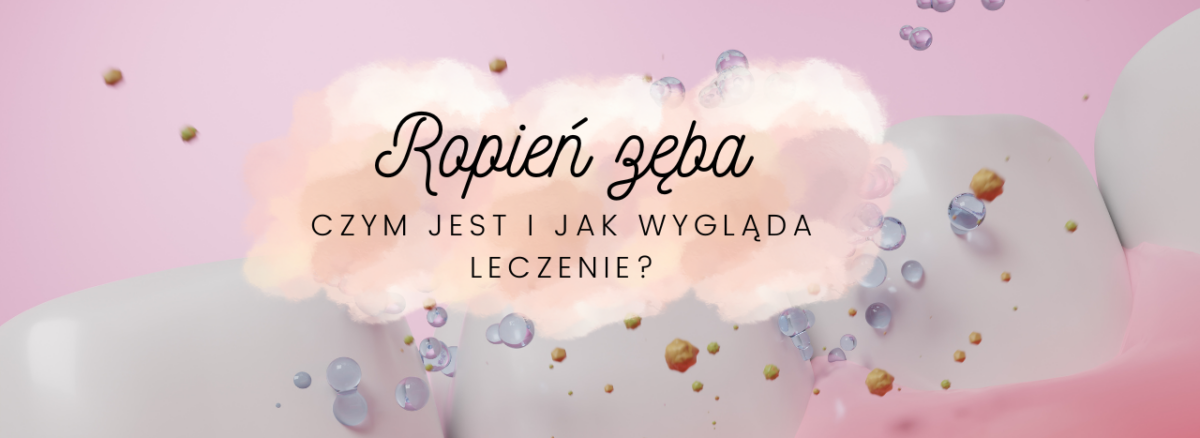 Ropień zęba - czym jest i jak wygląda leczenie