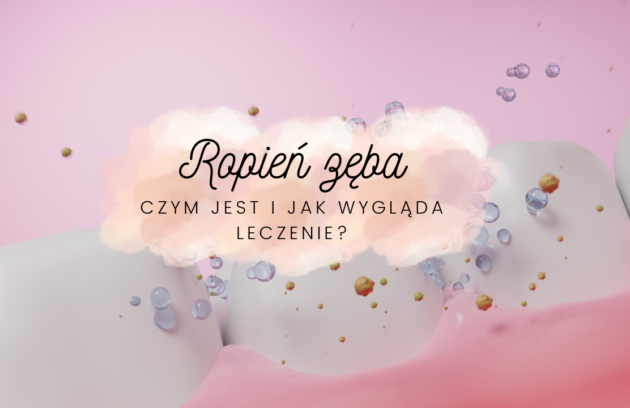 Ropień zęba - czym jest i jak wygląda leczenie
