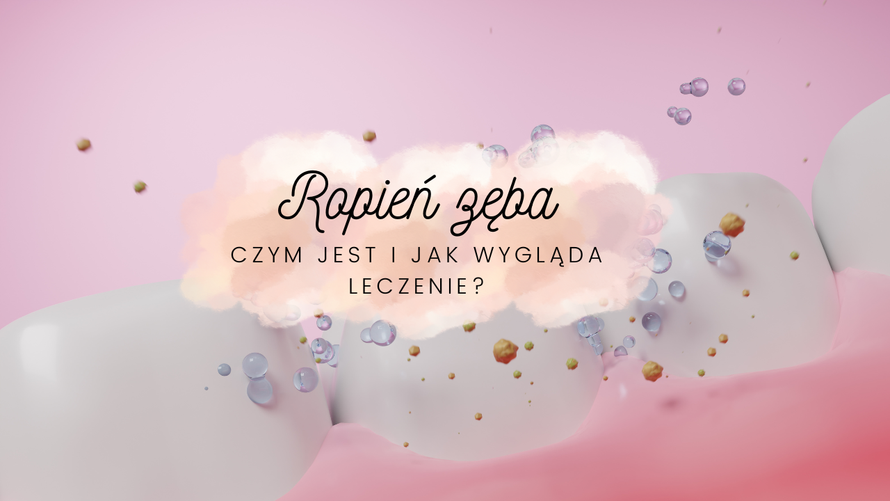 Ropień zęba - czym jest i jak wygląda leczenie? - Denteamed - lublin