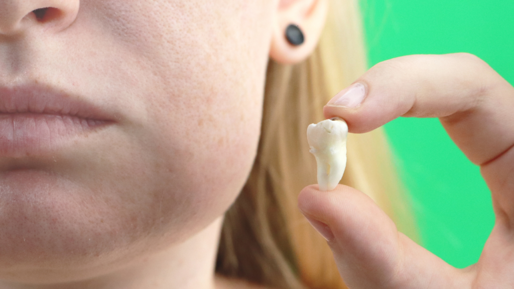 Ropień zęba - intensywny ból i obrzęk to pierwsze objawy których nie należy ignorować