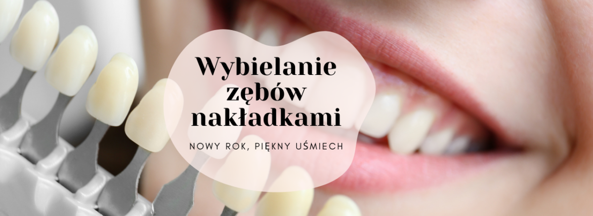 Wybielanie zębów nakładkami - nowy rok, piękny uśmiech