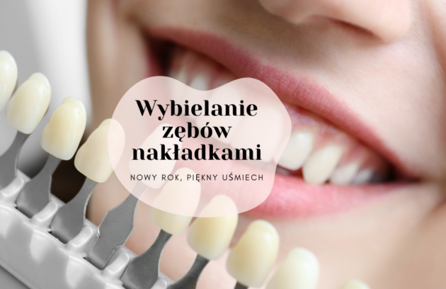 Wybielanie zębów nakładkami - nowy rok, piękny uśmiech