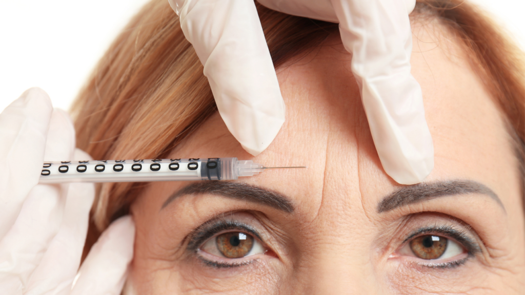 Botoks lwia zmarszczka - młodszy i zrelaksowany wyraz twarzy