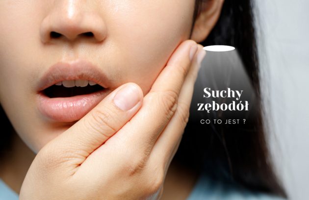 Suchy zębodół - co to jest