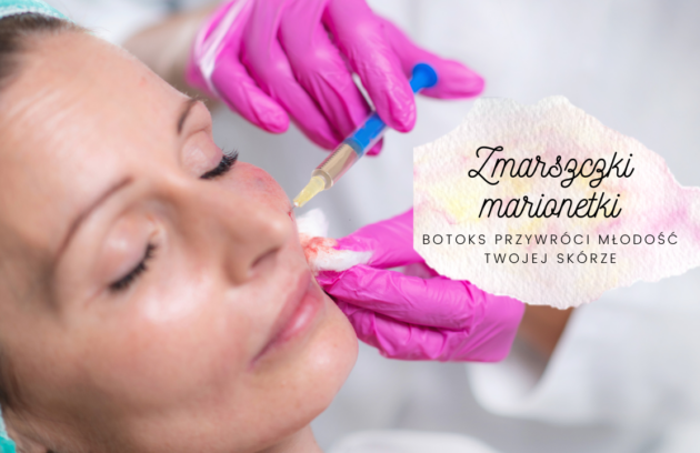 Zmarszczki marionetki -botoks przywróci młodość Twojej skórze