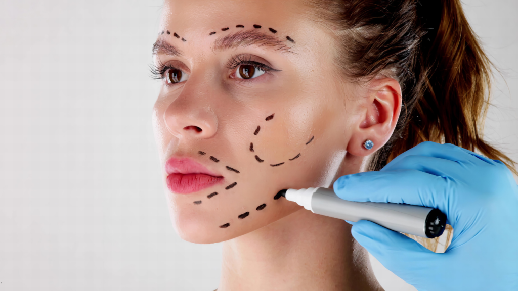 Wolumetria twarzy - Najczęściej modelowane obszary twarzy.png