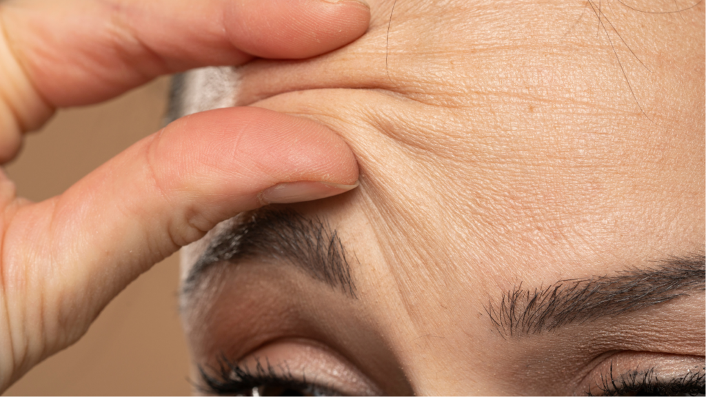 Zmarszczki na czole - jakie rodzaje zmarszczek wyróżniamy