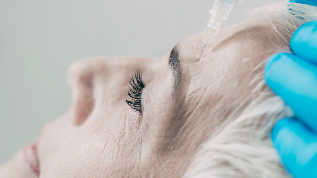 Jak wygląda zabieg botoksu na czole