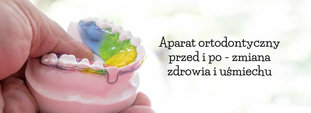 Aparat ortodontyczny przed i po - zmiana zdrowia i uśmiechu
