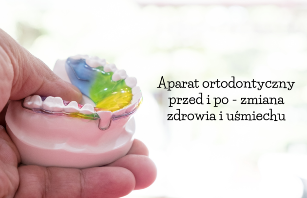 Aparat ortodontyczny przed i po - zmiana zdrowia i uśmiechu