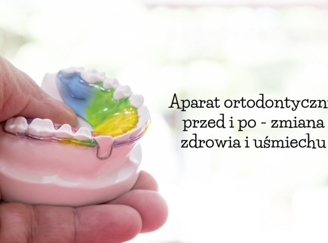 Aparat ortodontyczny przed i po - zmiana zdrowia i uśmiechu