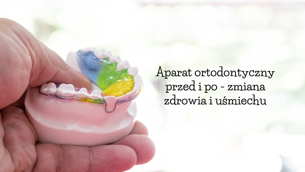 Aparat ortodontyczny przed i po - zmiana zdrowia i uśmiechu