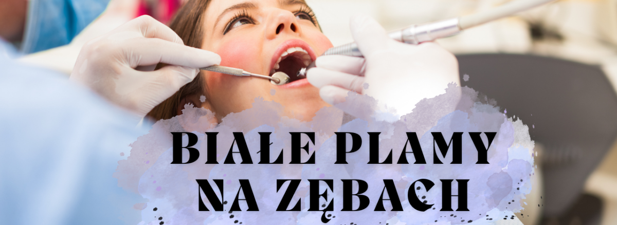 Białe plamy na zębach – skąd się biorą i jak się ich pozbyć?