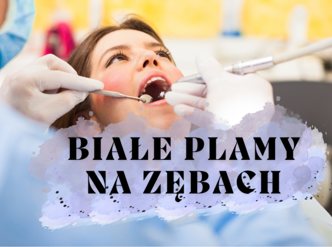 Białe plamy na zębach – skąd się biorą i jak się ich pozbyć?