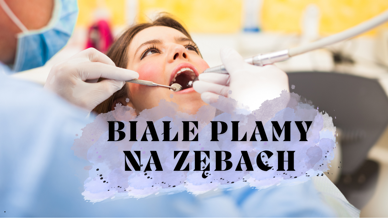 Białe plamy na zębach – skąd się biorą i jak się ich pozbyć?