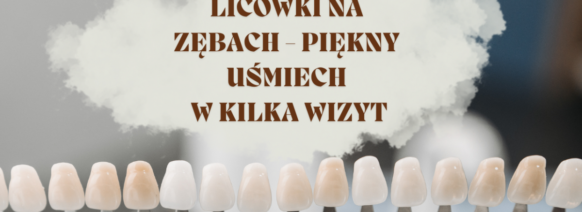 Licówki na zębach - piękny uśmiech w kilka wizyt