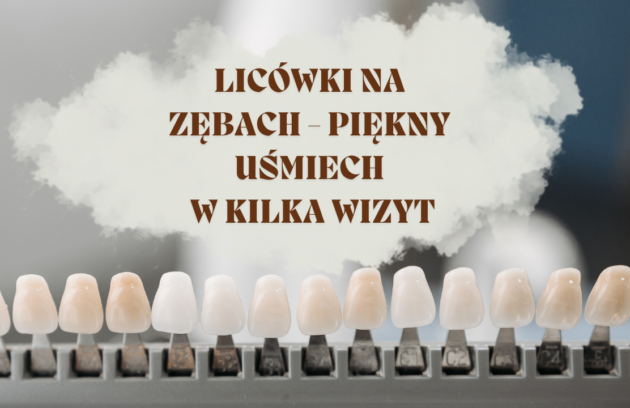Licówki na zębach - piękny uśmiech w kilka wizyt