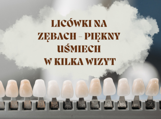 Licówki na zębach - piękny uśmiech w kilka wizyt