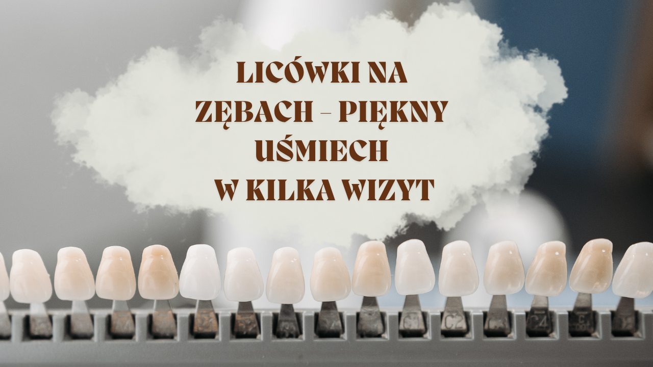 Licówki na zębach - piękny uśmiech w kilka wizyt