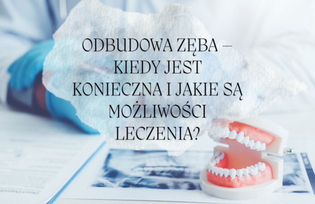 Odbudowa zęba – kiedy jest konieczna i jakie są możliwości leczenia?