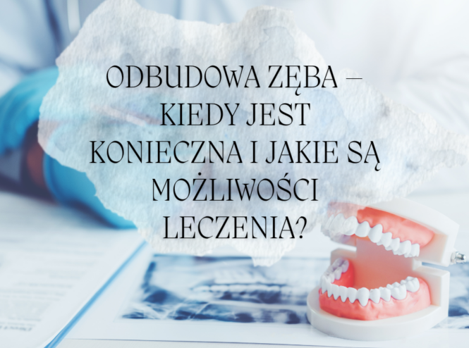 Odbudowa zęba – kiedy jest konieczna i jakie są możliwości leczenia?