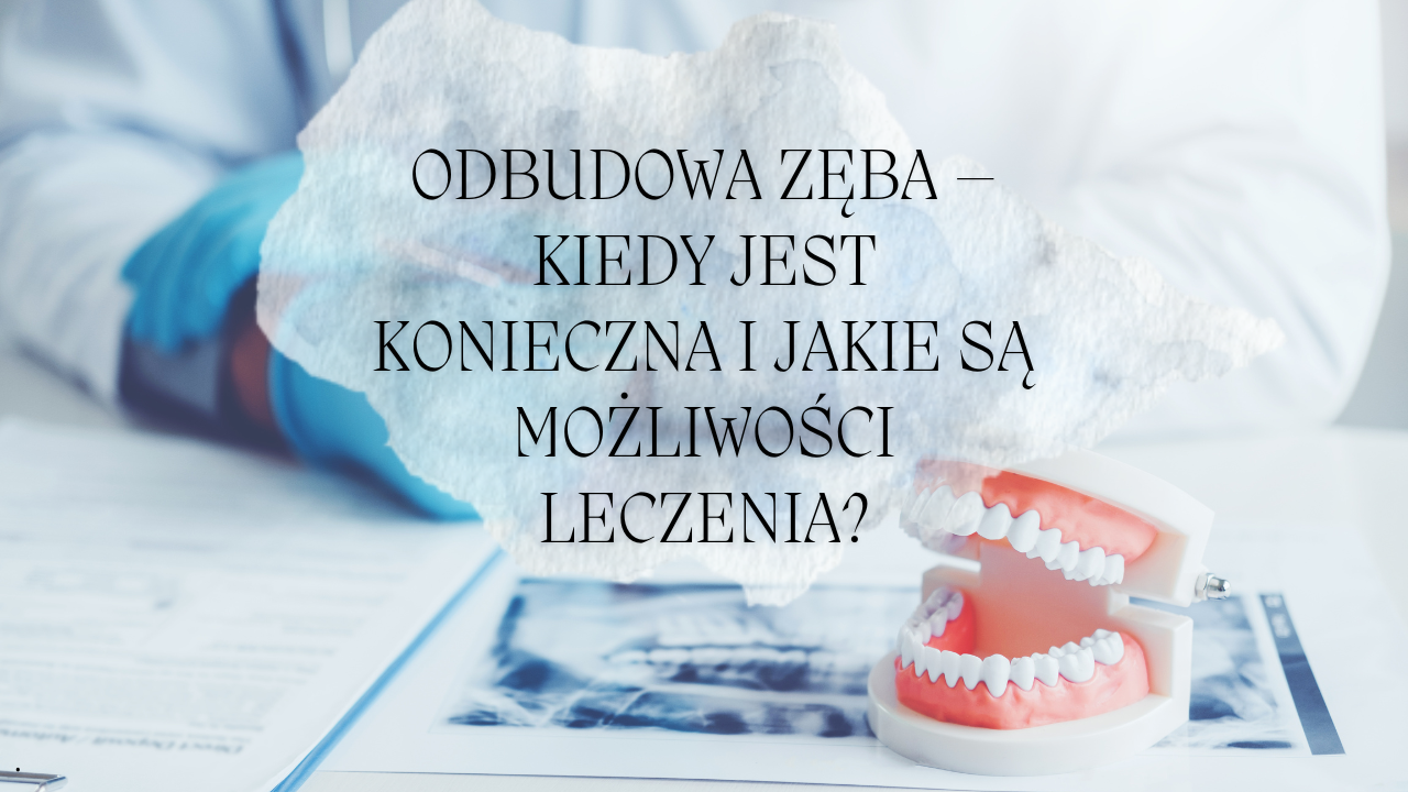 Odbudowa zęba – kiedy jest konieczna i jakie są możliwości leczenia?