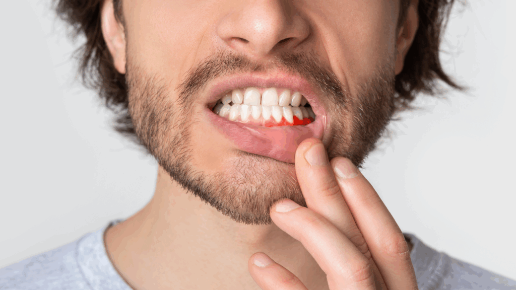 Kamień na zębach – czy nie mylisz go z próchnicą?